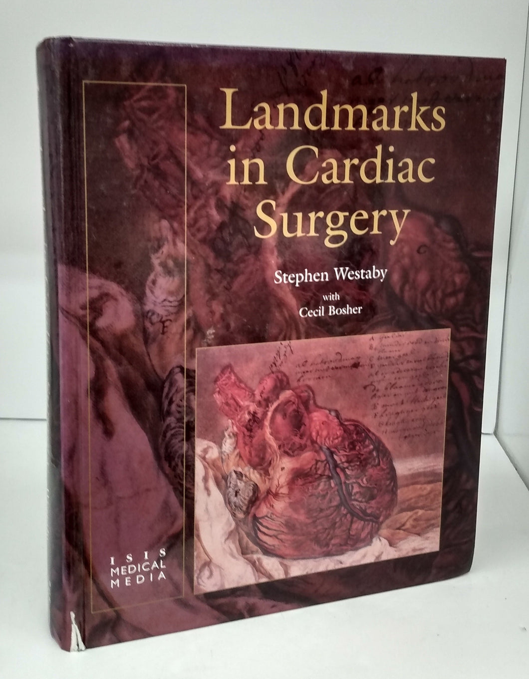 Landmarks in Cardiac Surgery