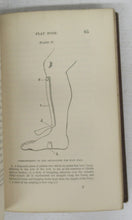 On the Cure of Clubfoot Without Cutting Tendons; and on Certain New Methods of Treating other Deformities