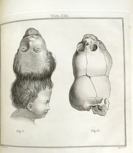 Lectures on Comparative Anatomy; In Which are Explained The Preparations in The Hunterian Collection